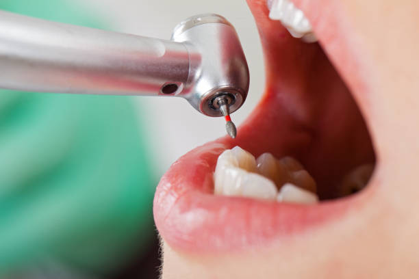 Best Emergency Broken Tooth Repair in Gainesville, TX